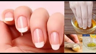 ASTUCE FAIRE POUSSER SES ONGLES PLUS VITE [upl. by Dnomyaw]