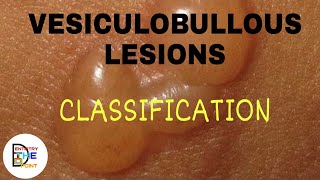 VESICULOBULLOUS LESIONS CLASSIFICATION [upl. by Lorenz]