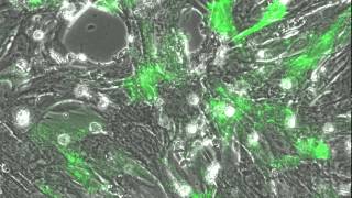 beating cardiomyocytes with green fluorescence [upl. by Elbertina]