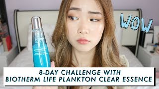 HOW I TRANSFORM MY SKIN IN 8 DAYS  BEFORE amp AFTER [upl. by Adnerak246]