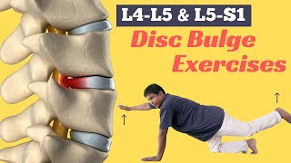 6 Best Diffuse Disc Bulge at L4L5 and L5S1 Treatment Exercises [upl. by Ja190]