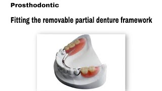 بروس Fitting the removable partial denture framework مرحلة رابعة طب الأسنان prosthodontic [upl. by Nivart]