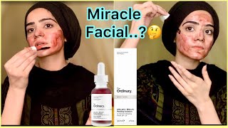 The Ordinary AHABHA Peeling Solution Review  Skin Care Product  Dietitian Aqsa [upl. by Rekab413]