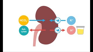 Treating acute salicylate toxicity [upl. by Anilatak]