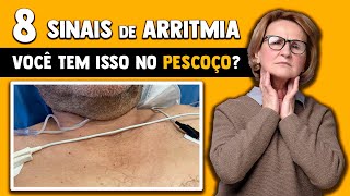 8 Sintomas da arritmia cardíaca │ Médico Explica [upl. by Nairod]