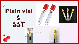 Plain tube  clot activator  Blood collection tubes  vacutainer [upl. by Enimzaj381]