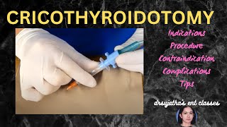 205cricothyroidotomy cricothyrotomy procedure airway emergency stridor [upl. by Linehan467]