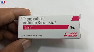 Tess Paste  Triamcinolone Acetonide Buccal paste  Tess Paste uses side effect benefit Review Hindi [upl. by Tugman744]