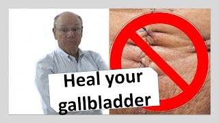 Heal your gallbladder naturally  NOW [upl. by Assile]