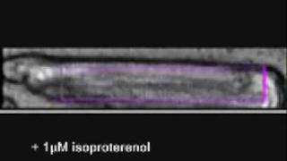 cardiac myocyte contractility [upl. by Aniar]