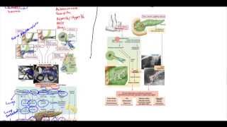 Acute Pancreatitis Chronic Pancreatitis Psuedocyst Adenocarcinoma [upl. by Tessy]