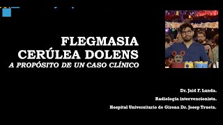 Flegmasia Cerúlea Dolen Revisión a propósito de un caso clínico [upl. by Ynaittirb]