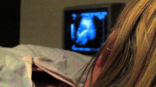 IVF diary  9  IVF the secret cycle  Embryo Transfer IVF [upl. by Hunter882]