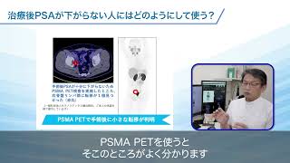 【第3回】『PSMA PETの応用』  PSMAが変える前立腺がん診療 [upl. by Christabelle]