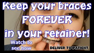 Keep your braces forever in your retainer Watch to see how [upl. by Eessac]