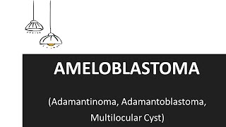 Ameloblastoma  Clinical Features and Treatment of Ameloblastoma [upl. by Neukam382]