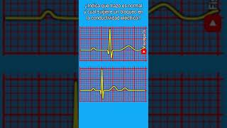 Electrocardiograma interpretación  ¿Indica que trazo es normal y cual sugiere un bloqueo [upl. by Dlabihcra493]