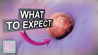 Embryo Transfer Day Behind the Scenes What to Expect [upl. by Matelda]