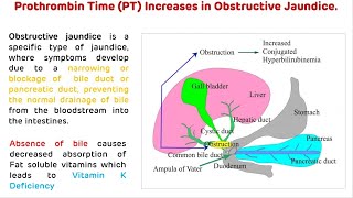 Why Prothrombin Time Increases In Obstructive Jaundice  Biochemistry Short Videos [upl. by Allehs496]