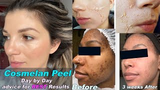 COSMELAN PEEL  Skin Expert SECRETS to CORRECT skin recovery and Best results2021 MUST WATCH [upl. by Bat]