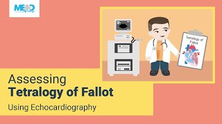 Assessing Tetralogy of Fallot Using Echocardiography [upl. by Adnamar437]