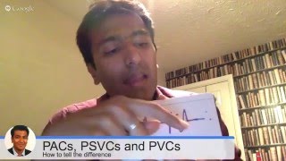 PACS PSVCS AND PVCS  whats the difference anyways [upl. by Rennie298]