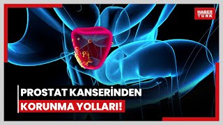 Prostat kanserinden korunma yolları Nüfus yaşlandıkça risk artıyor [upl. by Eybba]