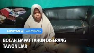 Bocah Empat Tahun Diserang Tawon Liar  Liputan 6 Palembang [upl. by Eulaliah902]