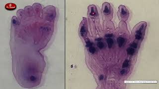 Intramembranous and endochondral ossification [upl. by Sink]