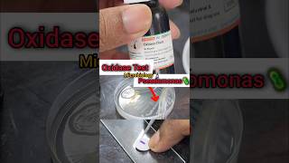 Oxidase Test 🧫🧪🔬🦠 Biochemicaltest  Microbiology Lab  Basics biochemistry shorts microbiology [upl. by Damien670]