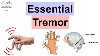 Essential Tremor  Causes Pathophysiology Symptoms Exacerbating Factors Diagnosis Treatment [upl. by Sumedocin271]