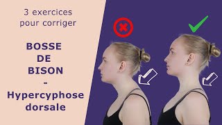 Hypercyphose dorsale  3 exercices pour corriger [upl. by Alesig]