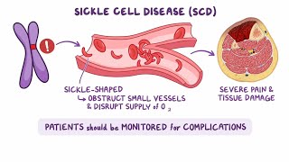 Sickle Cell Diseasemultiple questions with Rational 😇🥰 [upl. by Atilehs]