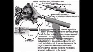 V2K  SYNTHETIC TELEPATHY OPERATORS THE UKs UNSEEN MURDERSUICIDE SQUADS [upl. by Adelice]