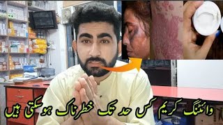 Rang Gora Karne Wali Cream Steroid Skin Whitening Cream Side Effects  in Hindi Urdu Ali Clinic [upl. by Liagaba]