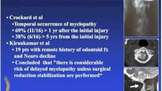 Spine Odontoid Fractures Overview and Surgical Treatment [upl. by Jonme]