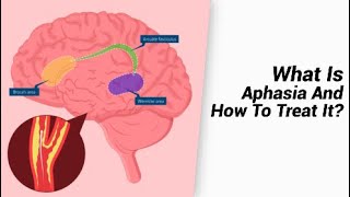 What Is Aphasia And How To Treat It [upl. by Okin]