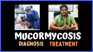 MUCORMYCOSIS Clinical features Diagnosis amp Treatment [upl. by Elockin522]