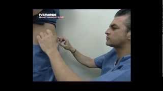 Lipolyse de labdomen par le Docteur Thierry LAFITTE TV5 Mondemp4 [upl. by Cousins]