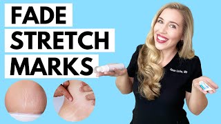 Fade Stretch Marks  Ingredients that WORK and the Science to Back it up [upl. by Vince]