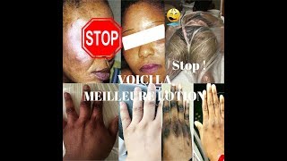 STOP A LA DEPIGMENTATION 🛑 LOTION ECLAIRCISSANTE PARDON REGARD CETTE VIDEO POUR PEAU NOIRE [upl. by Egidio]