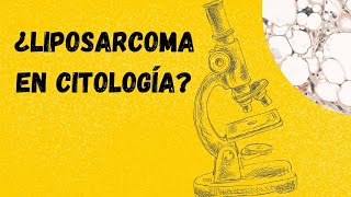 LIPOSARCOMA Diagnóstico citológico Tumores de partes blandas [upl. by Other568]