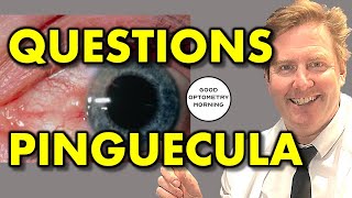 PINGUECULA QUESTIONS ANSWERED by YouTube Eye Doctor amp Optometrist yellow spot on eye explained [upl. by Yelrebmik]