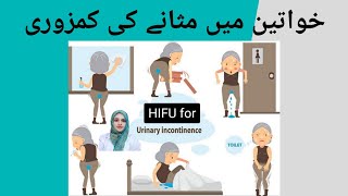 خواتین میں مثانے کی کمزوری  HIFU FOR URINARY INCONVENIENCE IN FEMALES drmaria foryou heal [upl. by Abramson]