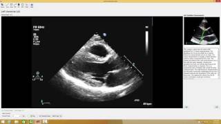 2 Echo Test and Teach Measurement Case [upl. by Avery]