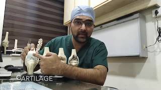 Why does knee pain occur In Hindi  Patient Education Video [upl. by Oap443]