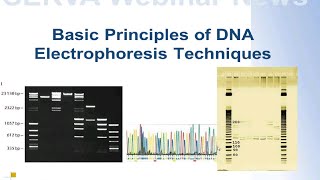 SERVA Webinar DNA Electrophoresis  The Basics English [upl. by Newlin142]