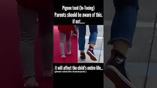 Pigeon Toed walking Intoeing baby walking  parents should be aware of shorts [upl. by Odom]