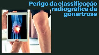 Perigo da classificação radiográfica da artrose [upl. by Itnuahsa439]