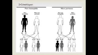 HEMATOLOGIE HEMOPHILIE [upl. by Adihsar]